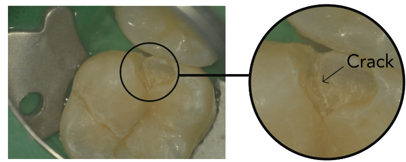 Dental microscope equipment